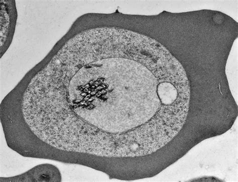  グレガリーナ：単細胞の寄生生物で、宿主の細胞を巧みに乗っ取る驚異！